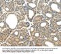 PLXNB2 Antibody