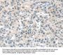 PLXNB2 Antibody