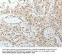 TOP1MT Antibody