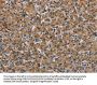 IL31RA Antibody