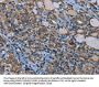 IL31RA Antibody