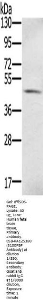 S100PBP Antibody