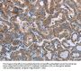 POMT1 Antibody