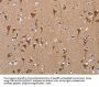 POMT1 Antibody