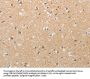 TACR2 Antibody