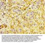 ACTA2 Antibody