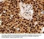SSB Antibody