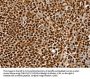 SSB Antibody