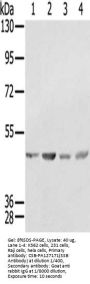 SSB Antibody