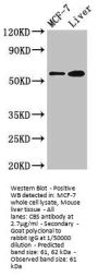 CBS Antibody