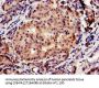 CBS Antibody