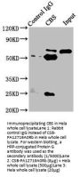 CBS Antibody
