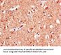 KL Antibody
