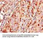 KL Antibody