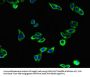 KL Antibody