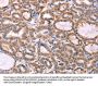 Rabbit anti-human PROS1 polyclonal antibody