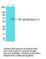 RELA (Ab-311) Antibody
