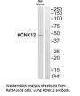KCNK12 Antibody