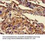 BCL2 Antibody