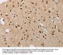 FASLG Antibody