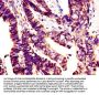 GLI1 Antibody