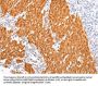 BSN Antibody
