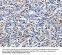 PIM1 Antibody