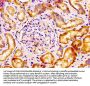 VTCN1 Antibody