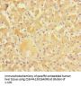NR1I3 Antibody