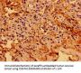 TGFB1I1 Antibody
