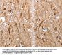 Map2 Antibody