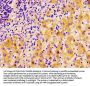 FASN Antibody