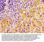 FASN Antibody