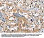 Rabbit anti-human CACNA1C polyclonal antibody