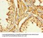 PAGE1 Antibody
