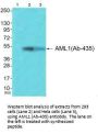 RUNX1 (Ab-435) Antibody