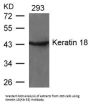 KRT18 (Ab-33) Antibody