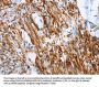 SHROOM2 Antibody