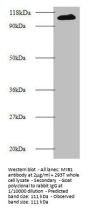 MIB1 Antibody
