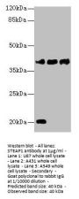 STEAP1 Antibody