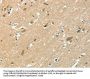 ASAH2 Antibody