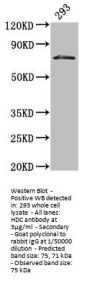 HDC Antibody