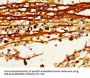 HDC Antibody