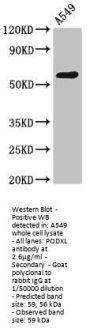 PODXL Antibody