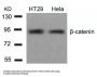 CTNNB1 (Ab-654) Antibody