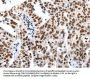 HDAC1 Antibody