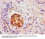 LIN28A Antibody