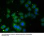 TROVE2 Antibody