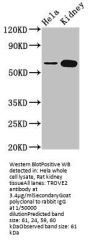 TROVE2 Antibody