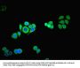 TROVE2 Antibody